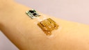 Smarter Pflaster auf einem Arm