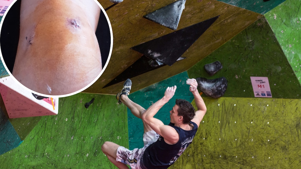 Jörns Knie und ein Sturz beim Bouldern