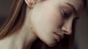 Junge Frau mit Leberfleck