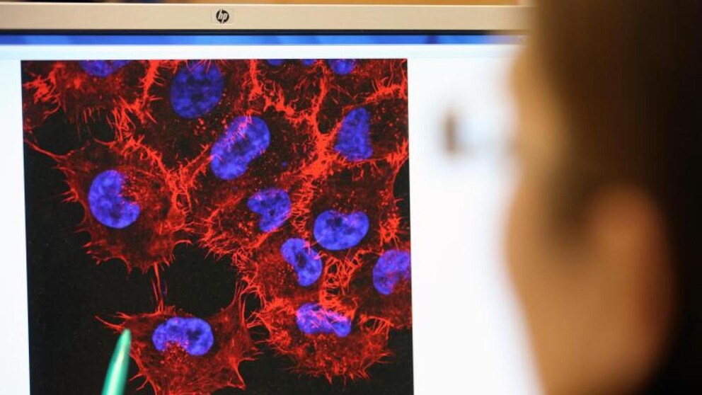 Hautkrebsdiagnostik