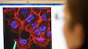 Hautkrebsdiagnostik
