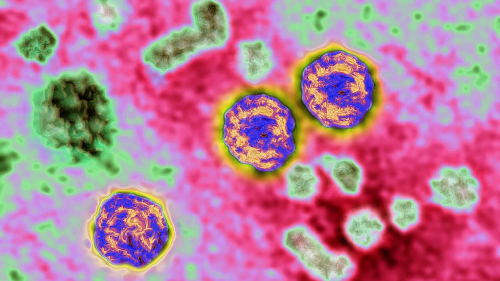 Hepatitis-B-Virus