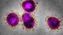 Ein Coronavirus unter dem Mikroskop