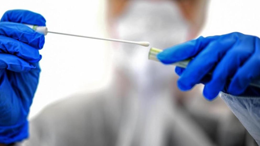 Bisher werden Tests in der Regel nur bei einem konkreten Infektionsverdacht durchgeführt