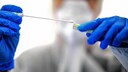 Bisher werden Tests in der Regel nur bei einem konkreten Infektionsverdacht durchgeführt