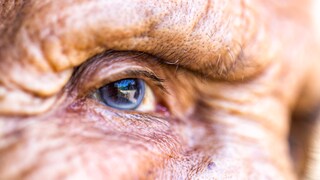 Beim Grauen Star trübt sich die Linse – eine typische Augenerkrankung im Alter