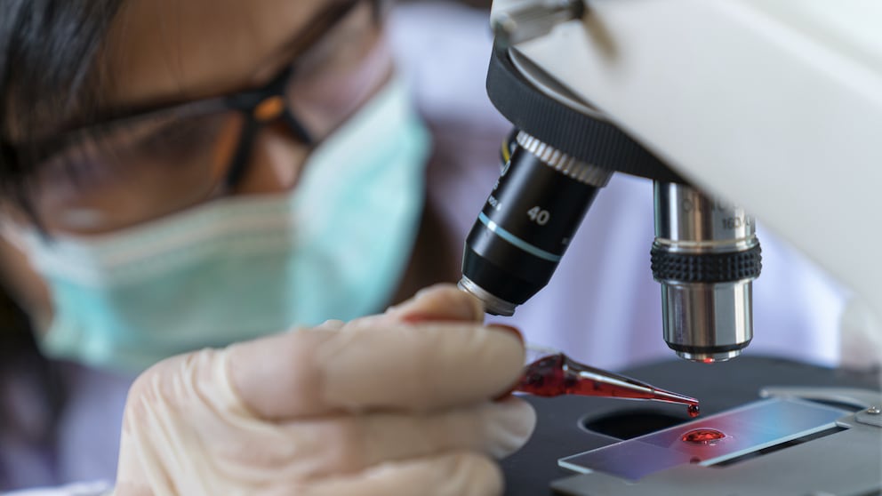 Antikörpertest: Ein Mediziner untersucht eine Blutprobe unter dem Mikroskop