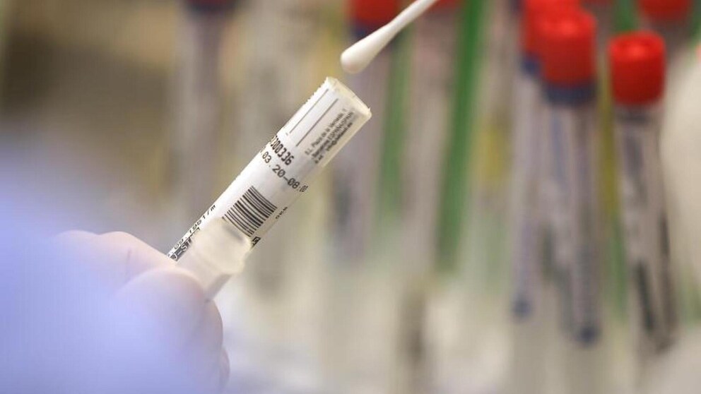 Im Labor werden zum Nachweis einer Infektion Abstriche aus dem Nasen-Rachen-Raum auf das Sars-CoV-2-Virus getestet.