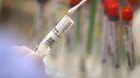 Im Labor werden zum Nachweis einer Infektion Abstriche aus dem Nasen-Rachen-Raum auf das Sars-CoV-2-Virus getestet.