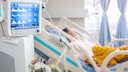 Jeder zweite beatmete Covid-19-Patient stirbt