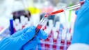 Plasmatherapie mit Coronavirus-Antikörpern