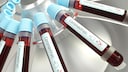 Die geplante Corona-Impfstoffstudie lehnen immer mehr Biotech-Firmen ab