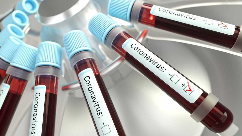 Die geplante Corona-Impfstoffstudie lehnen immer mehr Biotech-Firmen ab