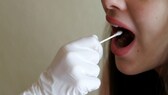 Inzidenzwert: Einer Frau wird ein Coronatest-Stäbchen in den Rachen geführt
