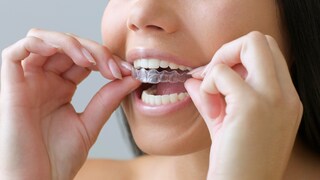 Bleaching der Zähne mithilfe einer Schiene