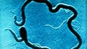 Syphilis