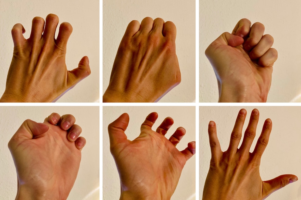Mausarm – auch das Mobilisieren der Finger hilft gegen die Schmerzen