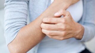 Frau kratzt sich am Unterarm