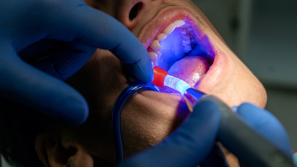 Zahnfüllungen: Mann beim Zahnarzt