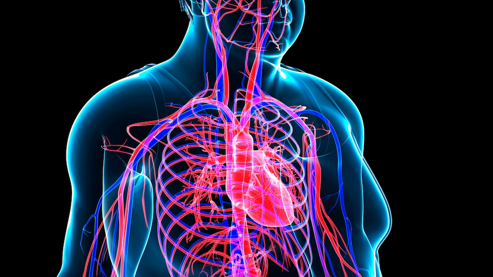Illustration des Gefäßsystems eines übergewichtigen Mannes