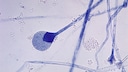 Pilzinfektion Covid-19: Pilzsporen eines Mucor sp. Pilzes
