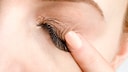 Fremdkörper im Auge