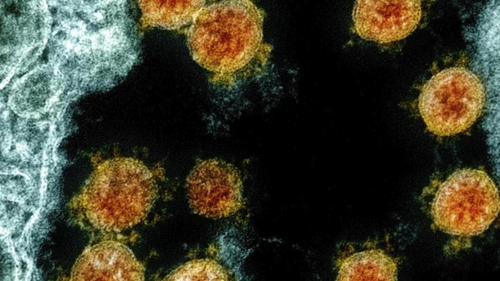 Delta-Variante Coronavirus