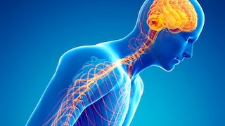 Computer-Illustration eines Parkinson-Patienten