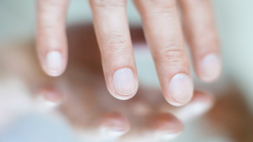 Misokinesie: Großaufnahme von Fingern einer Hand
