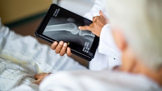 Arzt zeigt älterer Patientin Knochenschwund auf einem Röntgenbild