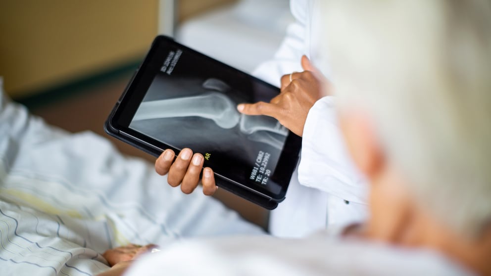 Arzt zeigt älterer Patientin Knochenschwund auf einem Röntgenbild