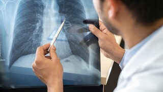 Ein Arzt untersucht eine Lunge auf COPD