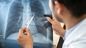 Ein Arzt untersucht eine Lunge auf COPD