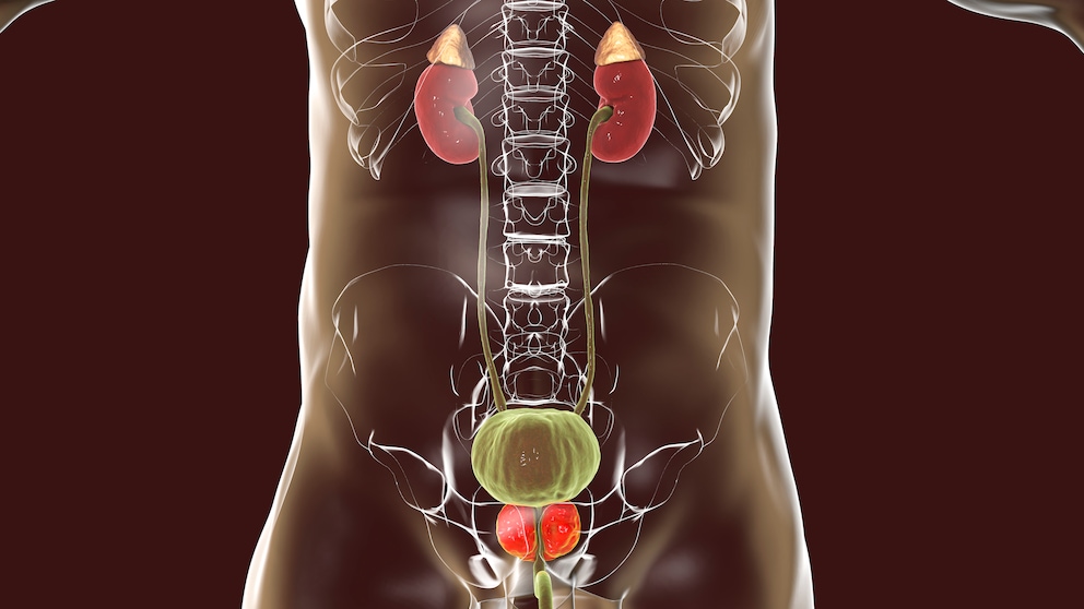 Ernährung Prostatakrebs: Symbolbild