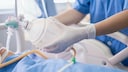 Sterberisiko nach Covid-Erkrankung: Patient wird auf Intensivstation beatmet