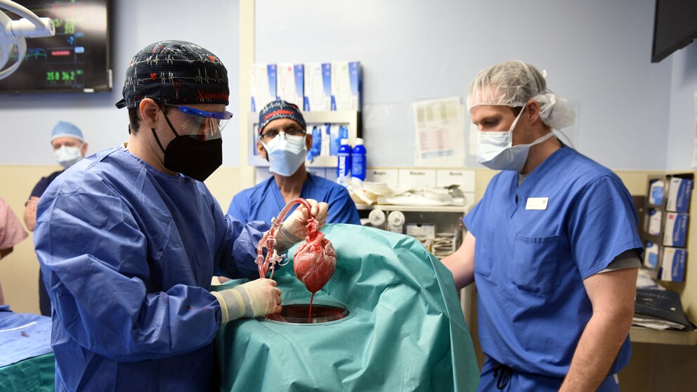 schweineherz transplantiert: Arzt hält Schweinherz vor Transplantation in Menschen in der Hand