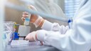 Was bedeutet das Ergebnis schwach positiv beim Corona-Test?: Labortest