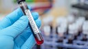 pcr-test nach positivem schnelltest: Corona-Tests im Labor