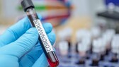 pcr-test nach positivem schnelltest: Corona-Tests im Labor