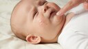 Baby mit Hautproblemen