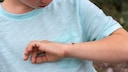 Zecken Kinder: Kind mit Zecke auf dem Arm