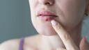 Lippenherpes schnell loswerden: Frau mit Lippenherpes fasst sich mit dem Finger an die Lippen.