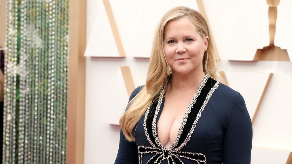 Trichotillomanie: Amy Schumer