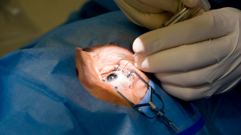 Auge Larven: Augen-OP