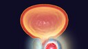 rauchen sterberisiko prostatakrebs: Illustration von Prostatakrebs