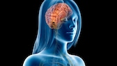 Magersucht Gehirn: Illustration vom Gehirn einer Frau