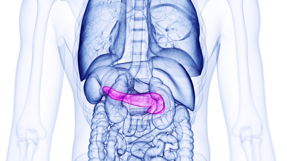 Bauchspeicheldrüsenkrebs sport