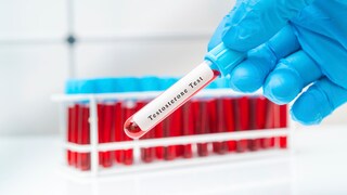 Blutprobe für Testosterontest