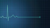 EKG Monitor