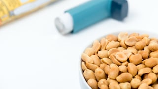 Eine Erdnussallergie kann im Urlaub zu einer Herausforderung werden